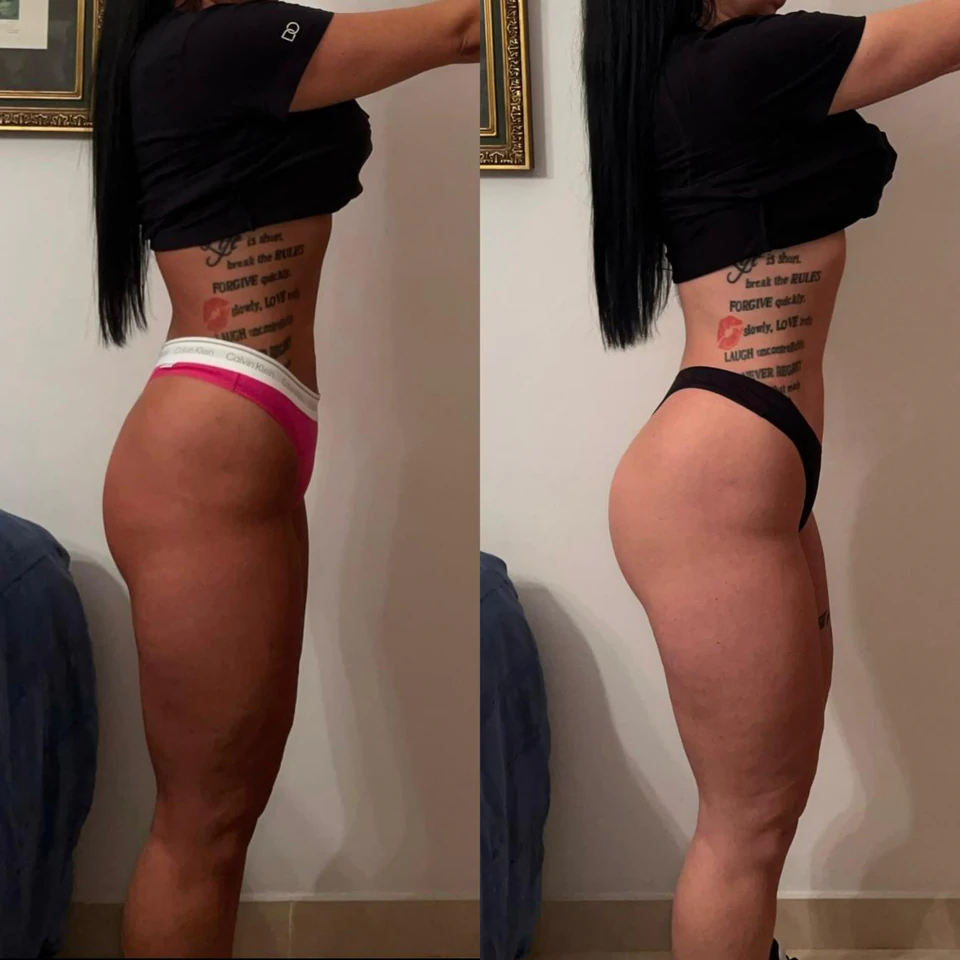 Comparação antes e depois de uma transformação com ganho de massa muscular.