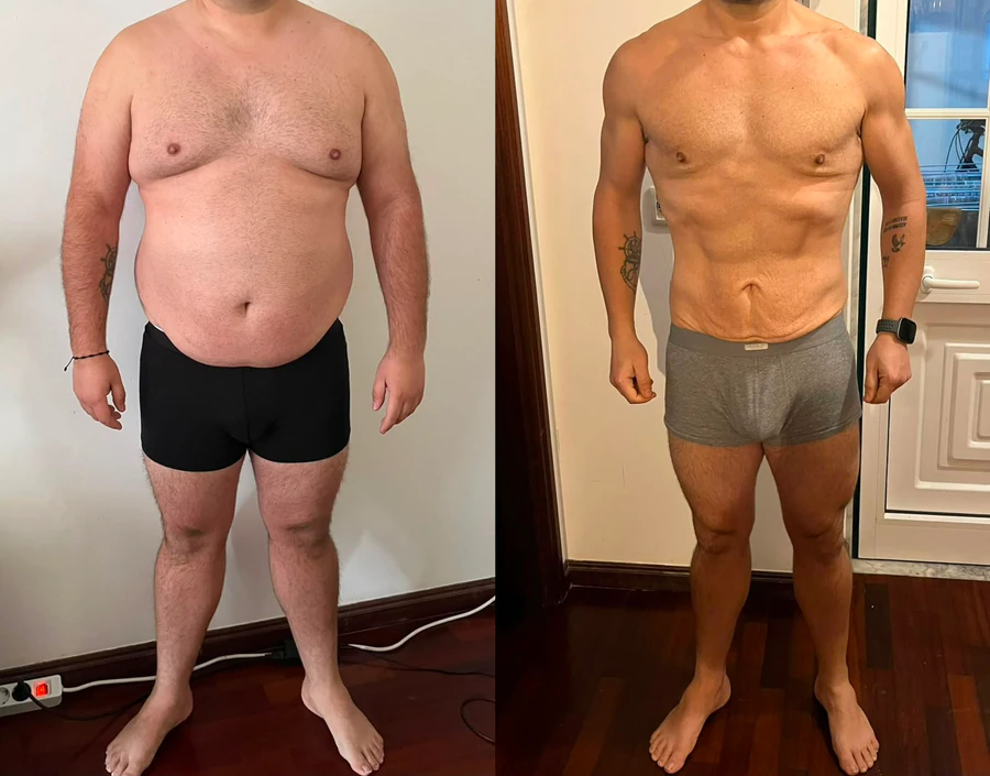 Resultado antes e depois de uma cliente.