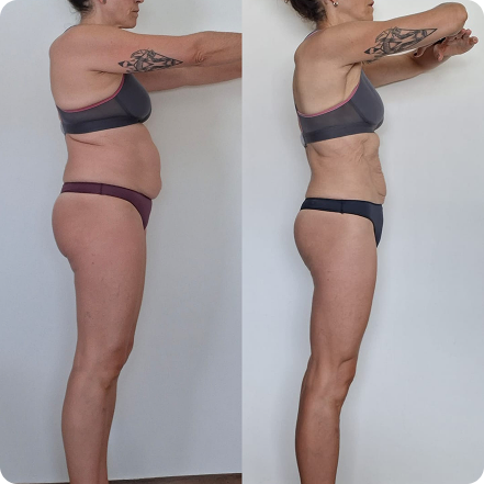 Comparação antes e depois de uma transformação com perda de 10 kg.