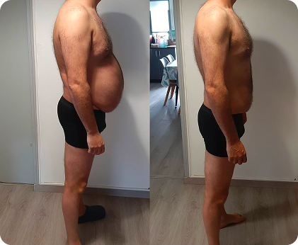 Comparação antes e depois de uma transformação com perda de 15 kg.