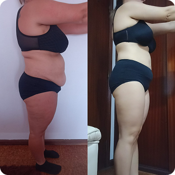 Comparação antes e depois de uma transformação com perda de 20 kg.