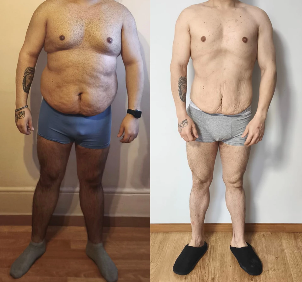 Comparação antes e depois de uma transformação com perda de 25 kg.